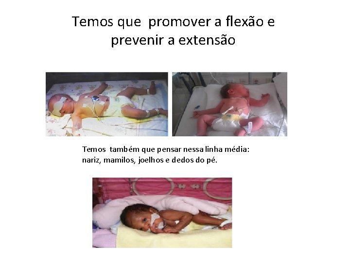 Temos que promover a flexão e prevenir a extensão Temos também que pensar nessa