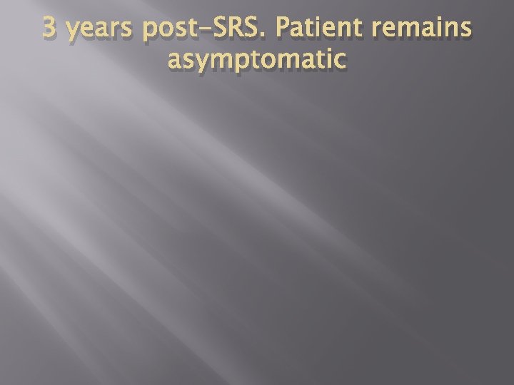 3 years post-SRS. Patient remains asymptomatic 