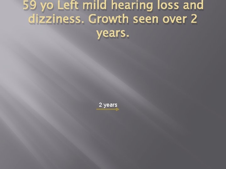 59 yo Left mild hearing loss and dizziness. Growth seen over 2 years 