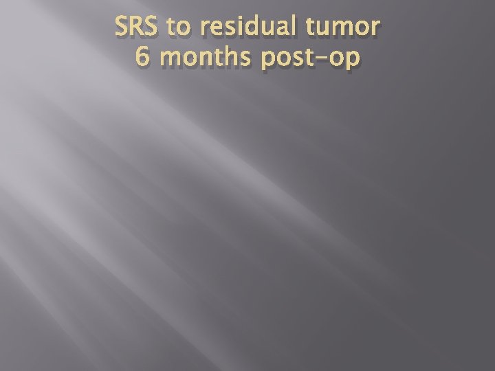 SRS to residual tumor 6 months post-op 