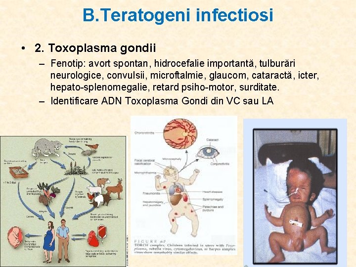 B. Teratogeni infectiosi • 2. Toxoplasma gondii – Fenotip: avort spontan, hidrocefalie importantă, tulburări