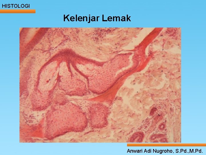 HISTOLOGI Kelenjar Lemak ____ Click__to____ edit Master _____ text styles ______ _____ _____ 24/05/2017 HISTOLOGI Kelenjar Lemak ____ Click__to____ edit Master _____ text styles ______ _____ _____ 24/05/2017