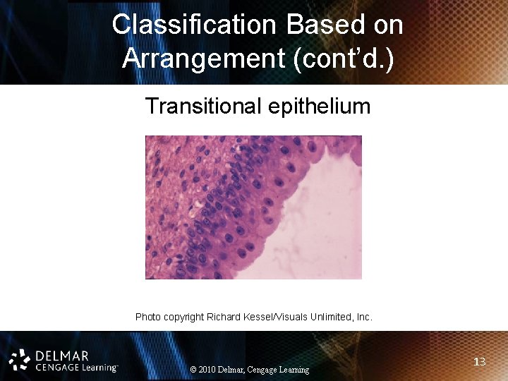 Classification Based on Arrangement (cont’d. ) Transitional epithelium Photo copyright Richard Kessel/Visuals Unlimited, Inc.