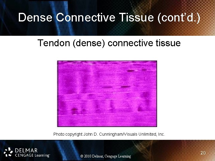 Dense Connective Tissue (cont’d. ) Tendon (dense) connective tissue Photo copyright John D. Cunningham/Visuals