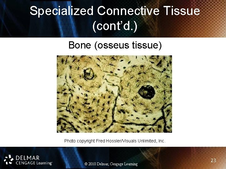 Specialized Connective Tissue (cont’d. ) Bone (osseus tissue) Photo copyright Fred Hossler/Visuals Unlimited, Inc.