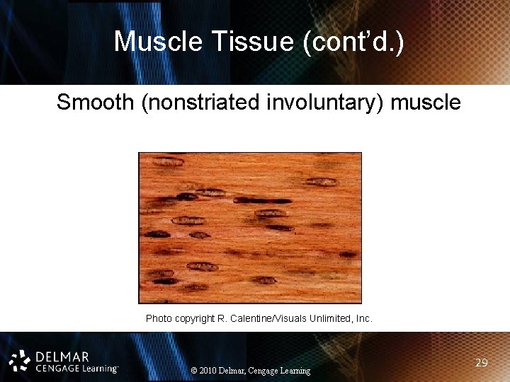 Muscle Tissue (cont’d. ) Smooth (nonstriated involuntary) muscle Photo copyright R. Calentine/Visuals Unlimited, Inc.