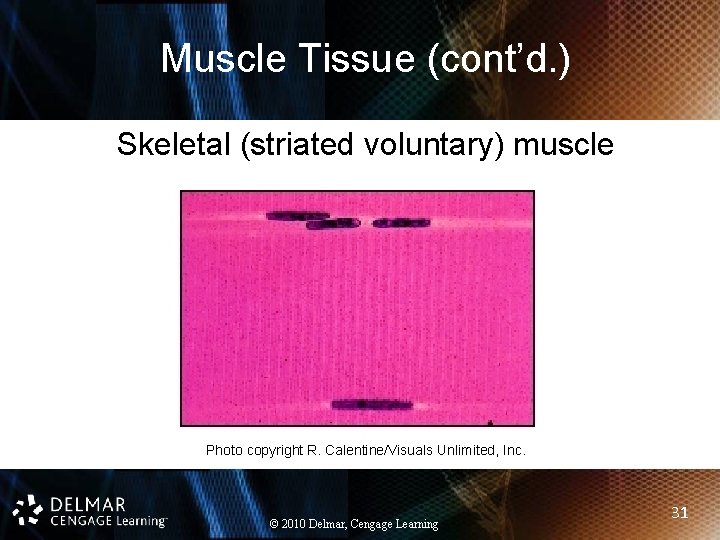 Muscle Tissue (cont’d. ) Skeletal (striated voluntary) muscle Photo copyright R. Calentine/Visuals Unlimited, Inc.