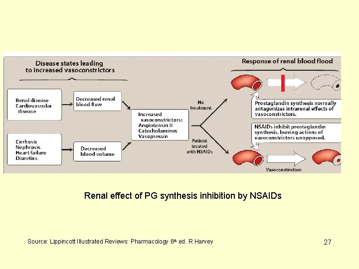 Renal effect of PG synthesis inhibition by NSAIDs Source: Lippincott Illustrated Reviews: Pharmacology 6