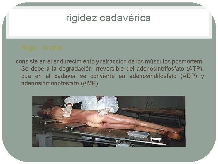 rigidez cadavérica • Rigor mortis consiste en el endurecimiento y retracción de los músculos rigidez cadavérica • Rigor mortis consiste en el endurecimiento y retracción de los músculos