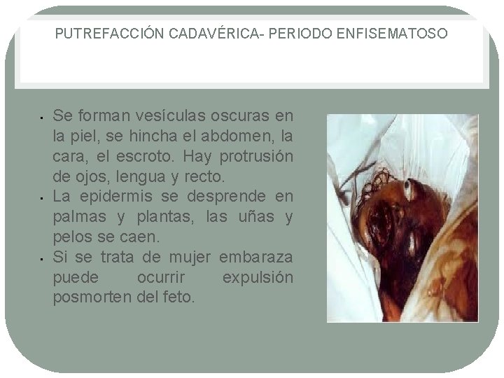 PUTREFACCIÓN CADAVÉRICA PERIODO ENFISEMATOSO • • • Se forman vesículas oscuras en la piel, PUTREFACCIÓN CADAVÉRICA PERIODO ENFISEMATOSO • • • Se forman vesículas oscuras en la piel,
