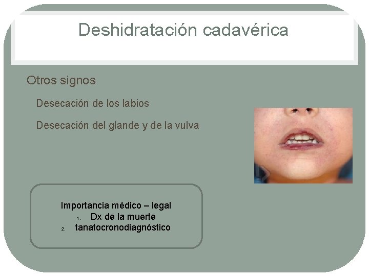 Deshidratación cadavérica Otros signos • Desecación de los labios • Desecación del glande y Deshidratación cadavérica Otros signos • Desecación de los labios • Desecación del glande y