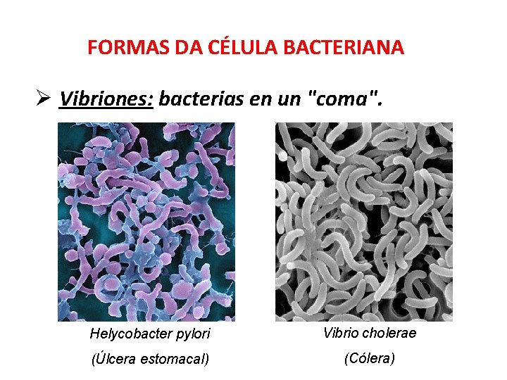 FORMAS DA CÉLULA BACTERIANA Ø Vibriones: bacterias en un "coma". Helycobacter pylori Vibrio cholerae