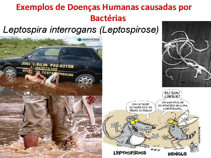 Exemplos de Doenças Humanas causadas por Bactérias Leptospira interrogans (Leptospirose) 