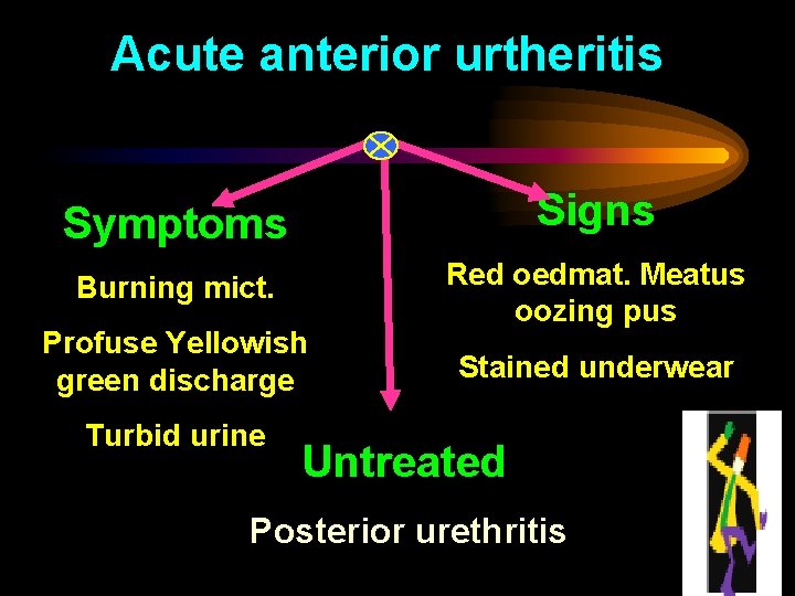 Acute anterior urtheritis Symptoms Signs Burning mict. Red oedmat. Meatus oozing pus Profuse Yellowish