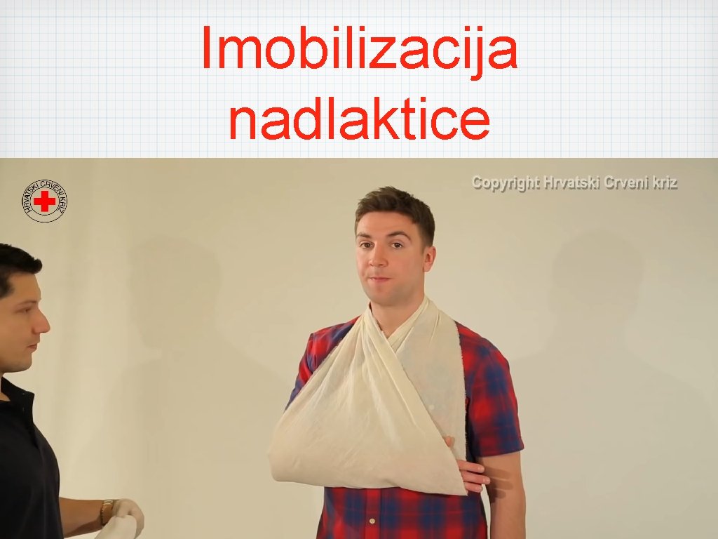 Imobilizacija nadlaktice 