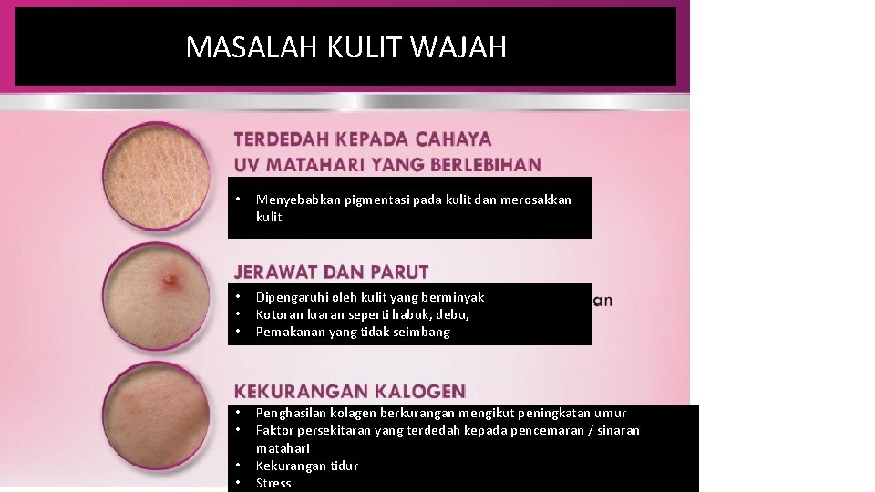 MASALAH KULIT WAJAH • Menyebabkan pigmentasi pada kulit dan merosakkan kulit • • •