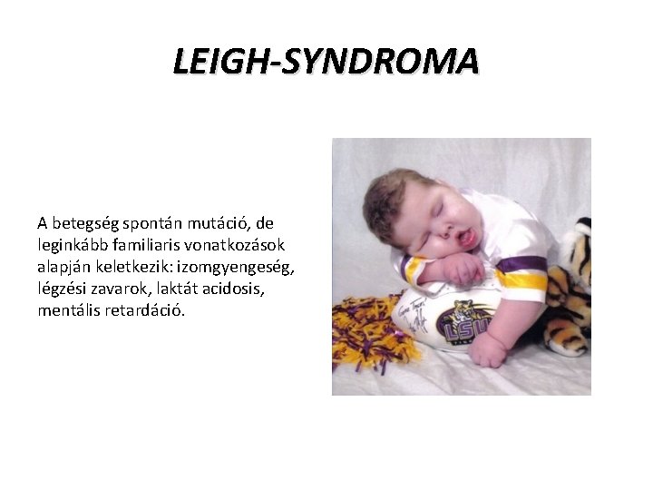 LEIGH-SYNDROMA A betegség spontán mutáció, de leginkább familiaris vonatkozások alapján keletkezik: izomgyengeség, légzési zavarok,