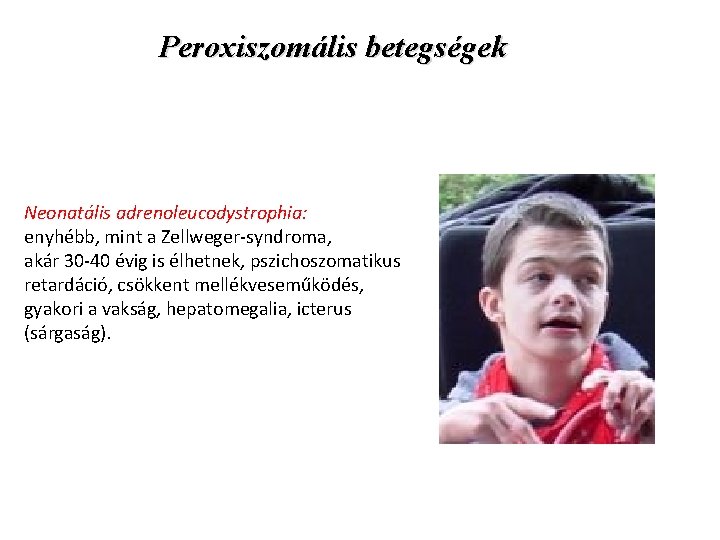 Peroxiszomális betegségek Neonatális adrenoleucodystrophia: enyhébb, mint a Zellweger-syndroma, akár 30 -40 évig is élhetnek,