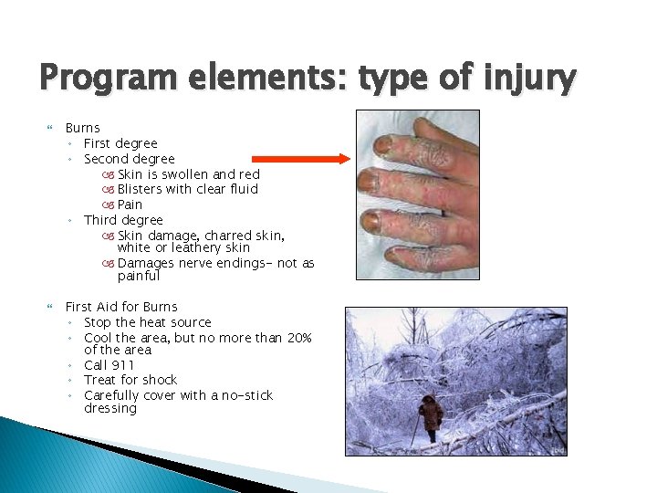 Program elements: type of injury Burns ◦ First degree ◦ Second degree Skin is