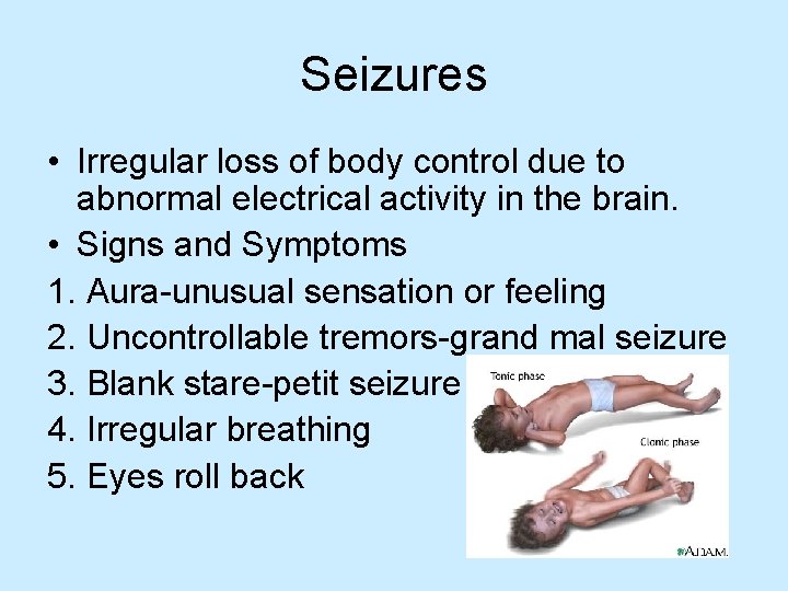 Seizures • Irregular loss of body control due to abnormal electrical activity in the