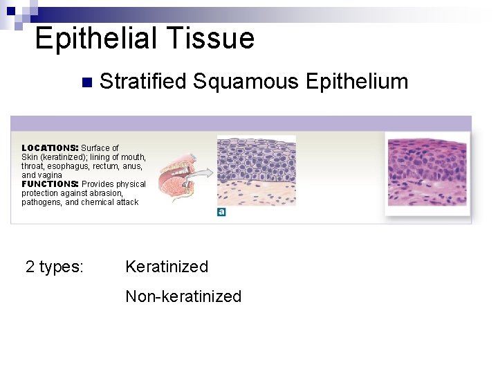 Epithelial Tissue n Stratified Squamous Epithelium LOCATIONS: Surface of Skin (keratinized); lining of mouth,