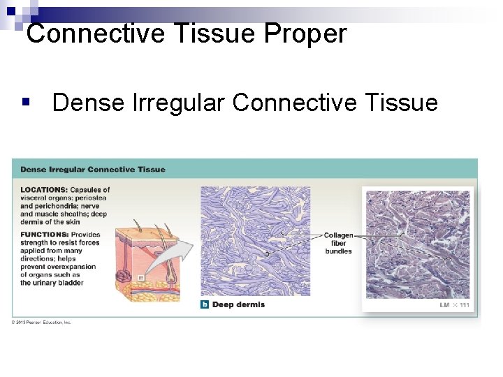 Connective Tissue Proper § Dense Irregular Connective Tissue 