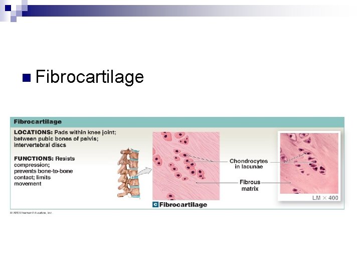 n Fibrocartilage 