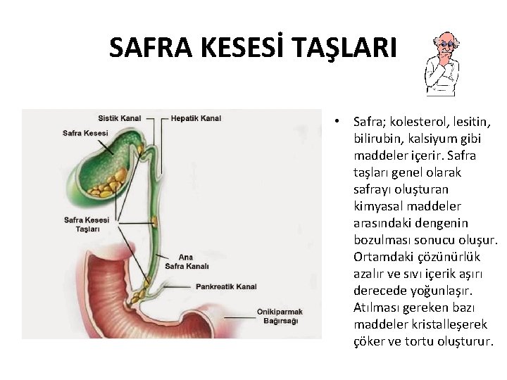 SAFRA KESESİ TAŞLARI • Safra; kolesterol, lesitin, bilirubin, kalsiyum gibi maddeler içerir. Safra taşları