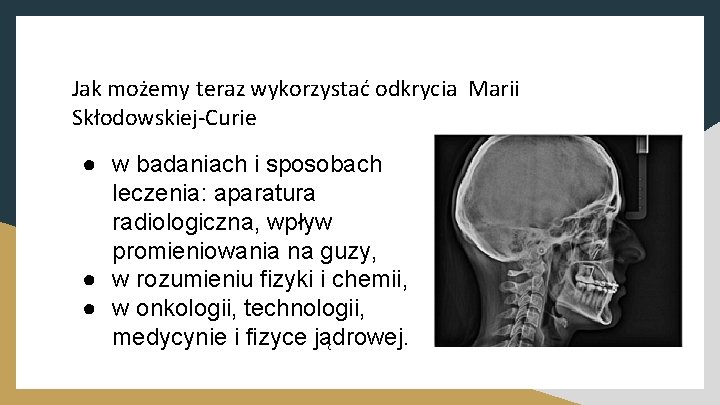 Jak możemy teraz wykorzystać odkrycia Marii Skłodowskiej-Curie ● w badaniach i sposobach leczenia: aparatura