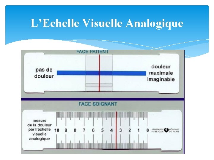 L’Echelle Visuelle Analogique 