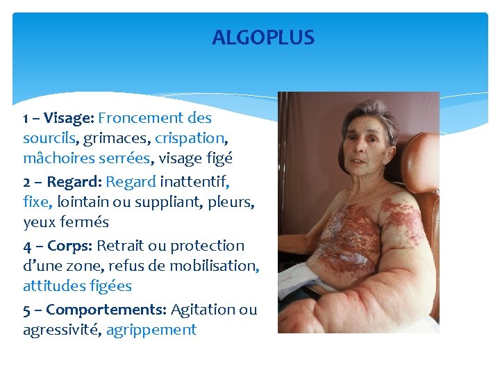 ALGOPLUS 1 – Visage: Froncement des sourcils, grimaces, crispation, mâchoires serrées, visage figé 2