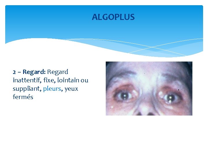 ALGOPLUS 2 – Regard: Regard inattentif, fixe, lointain ou suppliant, pleurs, yeux fermés 