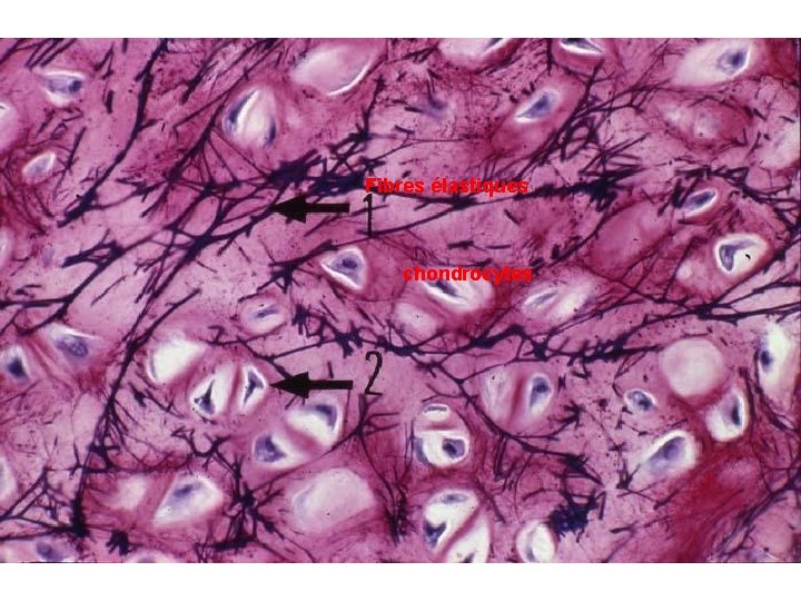 Fibres élastiques chondrocytes 