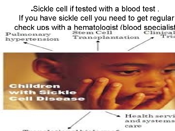 Sickle cell if tested with a blood test. If you have sickle cell you