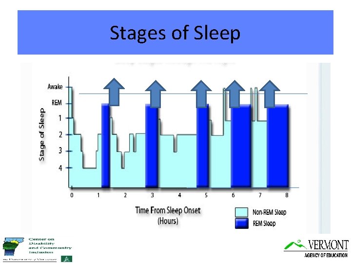 Stages of Sleep 