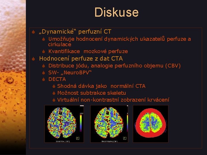 Diskuse S „Dynamické“ perfuzní CT S Umožňuje hodnocení dynamických ukazatelů perfuze a cirkulace S