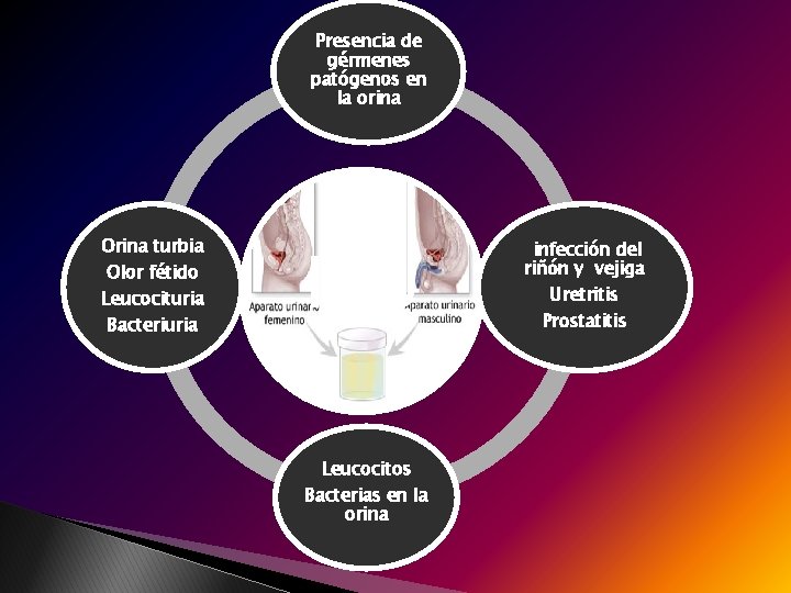 Presencia de gérmenes patógenos en la orina Orina turbia Olor fétido Leucocituria Bacteriuria ITU