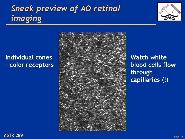 Sneak preview of AO retinal imaging Individual cones – color receptors ASTR 289 Watch