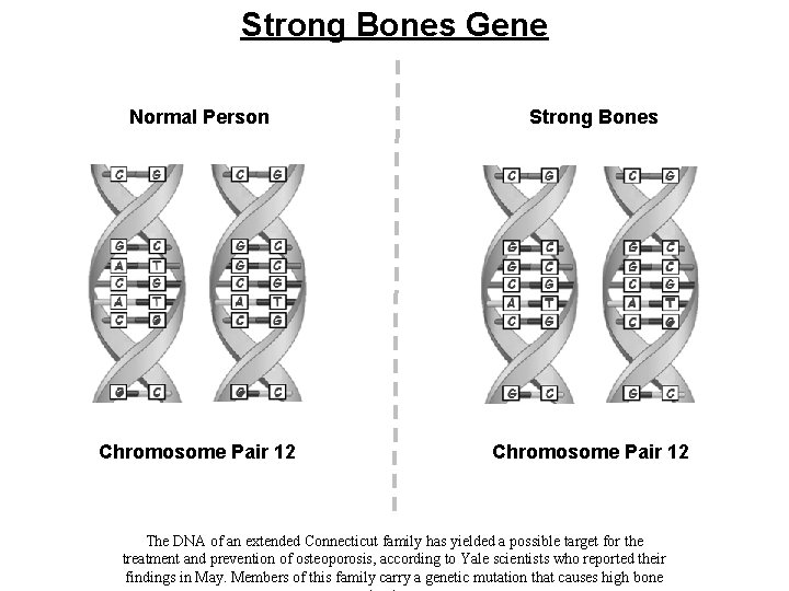 Strong Bones Gene Normal Person Strong Bones Chromosome Pair 12 The DNA of an