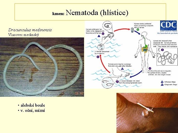 kmen: Dracunculus medinensis Vlasovec medinský • alebské boule • v. oční, mízní Nematoda (hlístice)