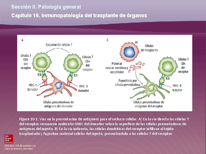 Sección II. Patología general Capítulo 10. Inmunopatología del trasplante de órganos Figura 10 -1.
