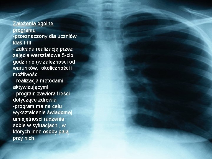 Założenia ogólne programu -przeznaczony dla uczniów klas I-III - zakłada realizację przez zajęcia warsztatowe