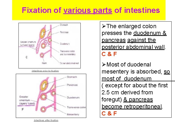 Fixation of various parts of intestines ØThe enlarged colon presses the duodenum & pancreas