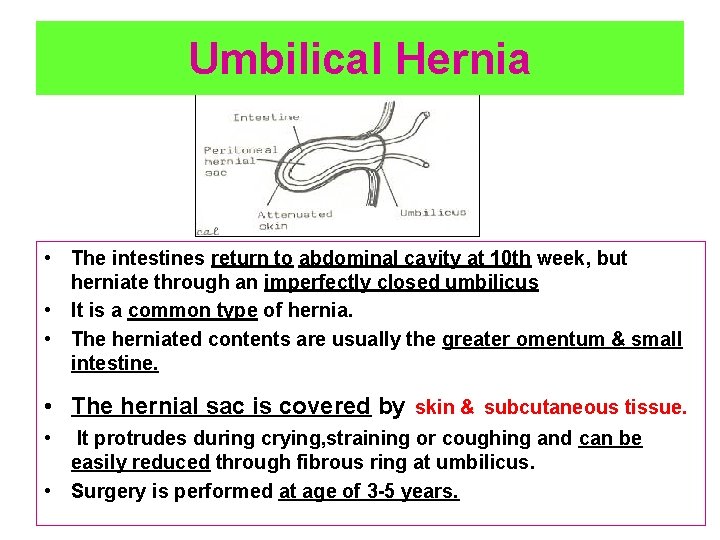 Umbilical Hernia • The intestines return to abdominal cavity at 10 th week, but