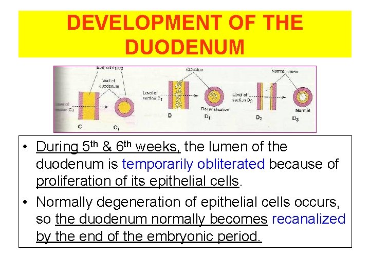 DEVELOPMENT OF THE DUODENUM • During 5 th & 6 th weeks, the lumen