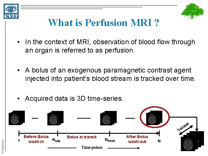 What is Perfusion MRI ? • In the context of MRI, observation of blood