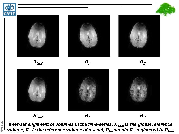 IIIT Hyderabad Rfinal R 3 Rfinal R 2 Rf 2 Inter-set alignment of volumes