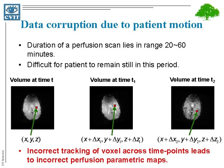 Data corruption due to patient motion • Duration of a perfusion scan lies in