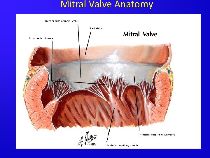 Mitral Valve Anatomy Wall Shear Stress averaged over the cardiac cycle 