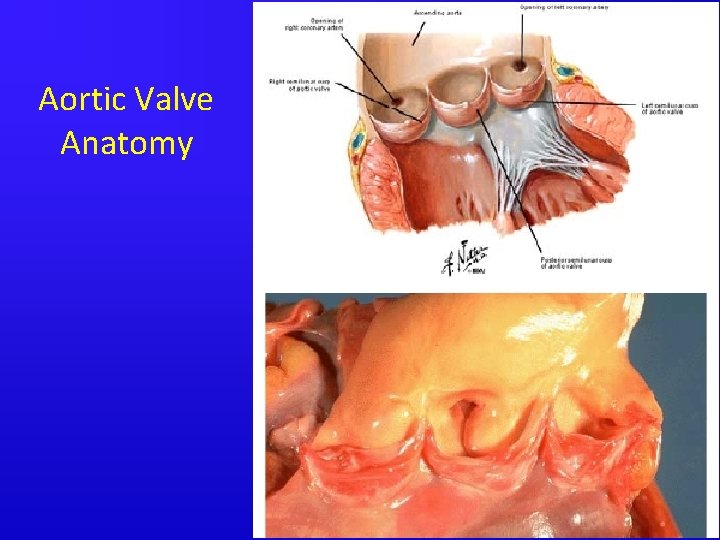 Aortic Valve Anatomy 